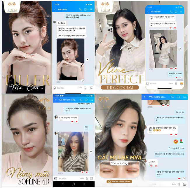 Em không thấy bầm hay sưng gì chị ạ - Mặt gọn xinh quá - Em rất ưng mũi bh luôn - Chăm sóc tận tâm chu đáo