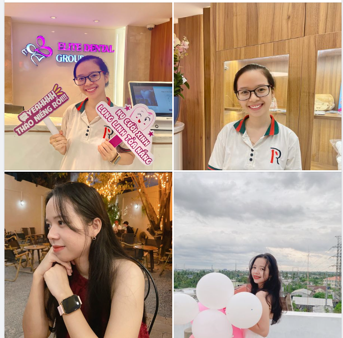 Thoát khỏi ‘’cơn ác mộng’’ đ.au khớp thái dương hàm sau 2 năm niềng răng tại Elite Dental.