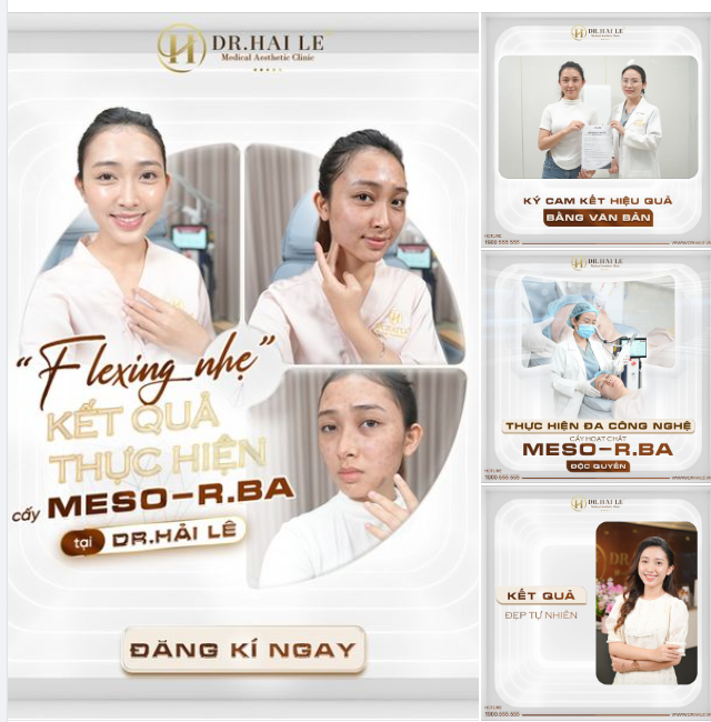 Dù không "để ý" cũng thấy rõ được làn da của khách hàng Linh Phương đã thay đổi như thế nào sau khi cấy Meso-R.BA tại Dr.Hải Lê.