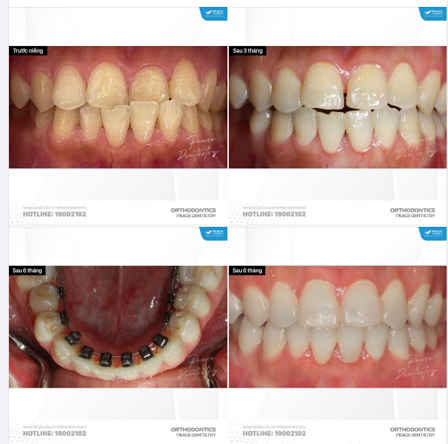 ORTHODONTICS PROCESSING