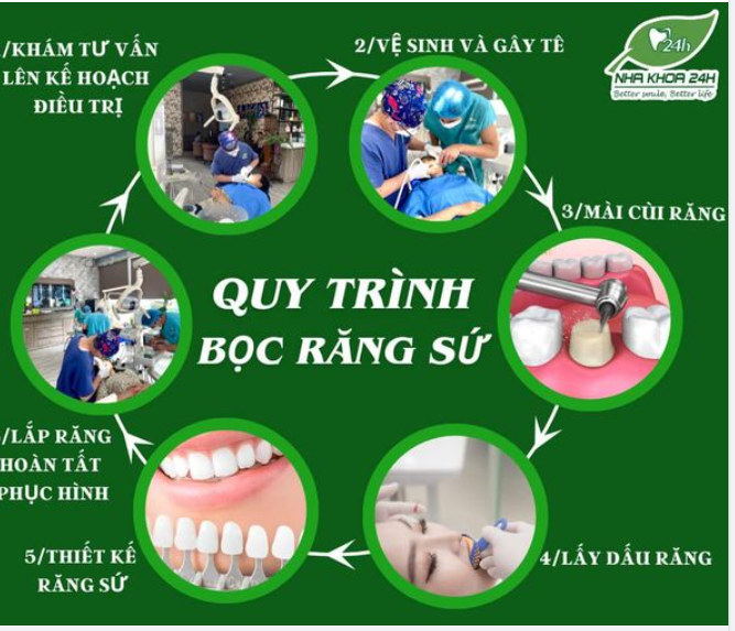 Để hoàn thiện thành công việc làm cầu răng sứ, một quy trình chuẩn cần tuân theo là vô cùng quan trọng.