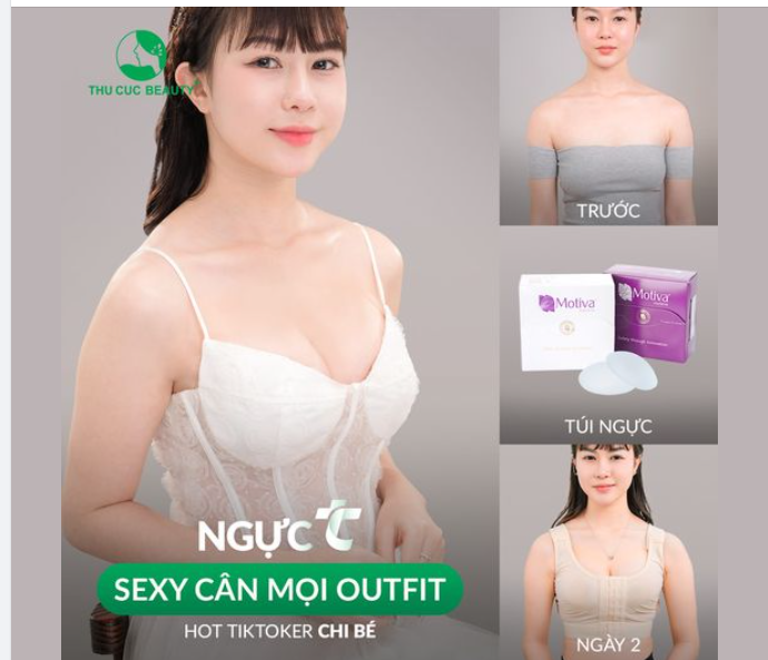 V1 căng mềm quyến rũ sau 60P Chọn Ngực TC