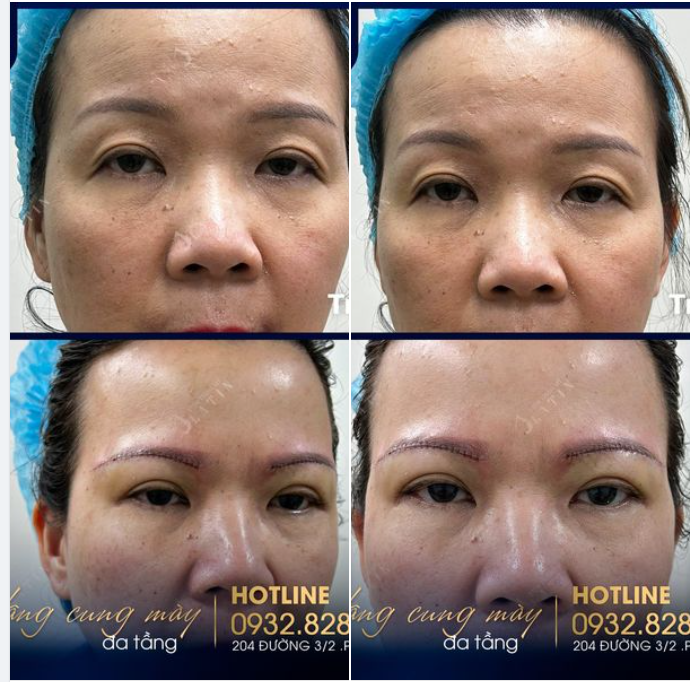 Đây là lý do chị em cần NÂNG CUNG MÀY
