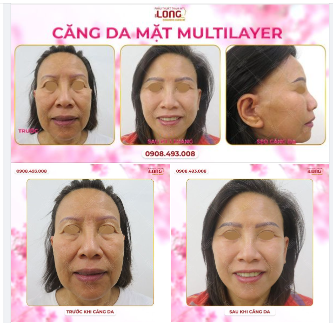 ĐỪNG ĐI “XIN VÍA” HÃY HÀNH ĐỘNG NẾU BẠN MUỐN ĐẸP