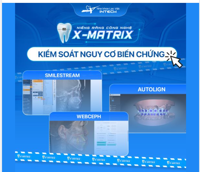 X -MATRIX KIỂM SOÁT NGUY CƠ XẢY RA BIẾN CHỨNG NHƯ THẾ NÀO?