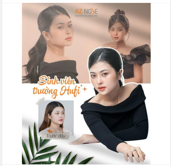 "Cơ hội công việc mẫu ảnh rộng mở hơn từ khi em nâng mũi"