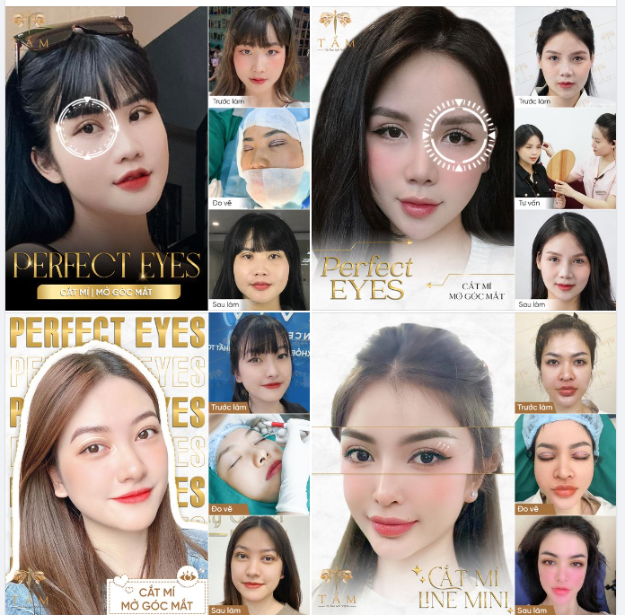 NẾU KHÓ QUÁ, CỨ ĐỂ TẤM LO