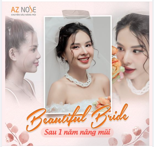 Trở thành cô dâu xinh đẹp và rạng rỡ nhất sau 1năm nâng mũi