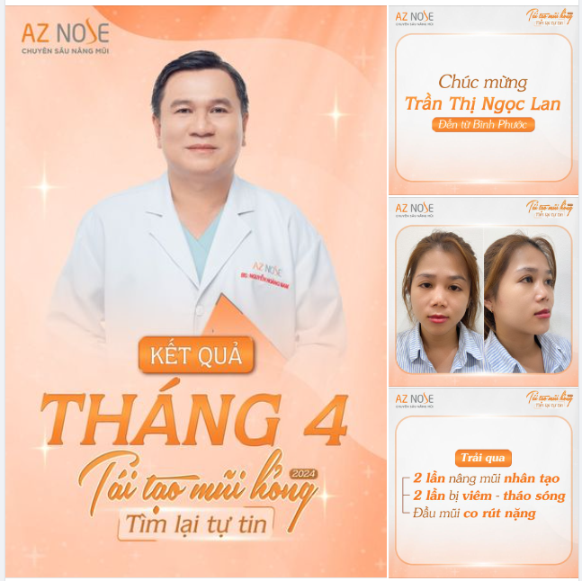 Chúc mừng khách hàng đầu tiên của chương trình "TÁI TẠO MŨI HỎNG" 2024