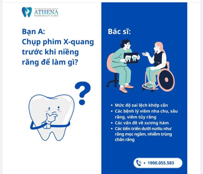 CHỤP PHIM QUAN TRỌNG NHƯ NÀO KHI NIỀNG RĂNG?