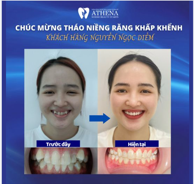 CHÚC MỪNG THÁO NIỀNG