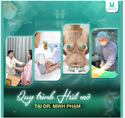 Quy trình hút mỡ siết eo chuẩn Y khoa tại Dr. Minh Phạm