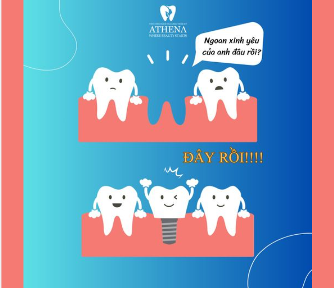 "NGOAN XINH YÊU CỦA ANH ĐÂU RỒIII!  ĐÂY RỒI  ĐÂY LÀ AI ĐẤY?  IMPLANT!!!"