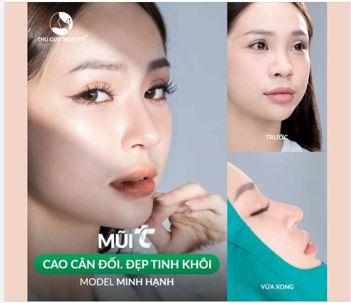 Đại lễ Mũi Mí Ngực -30% Mũi TC hôm nay giảm đến 30.4Tr