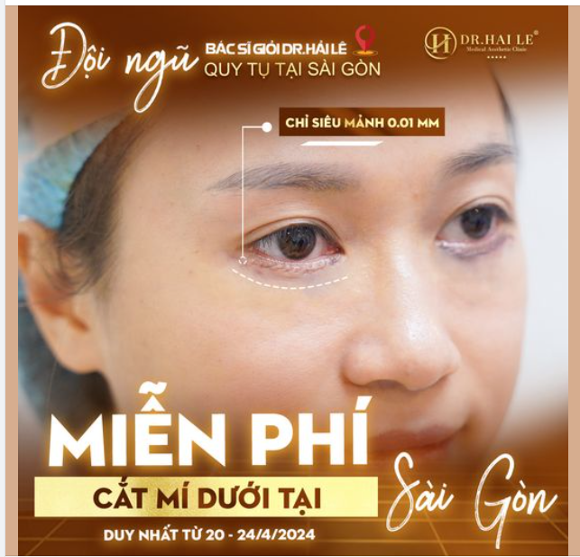 Ưu đãi sốc : Cắt mí dưới 0 đồng tại Dr Hải Lê Sài Gòn. bạn đã sẵn sàng 