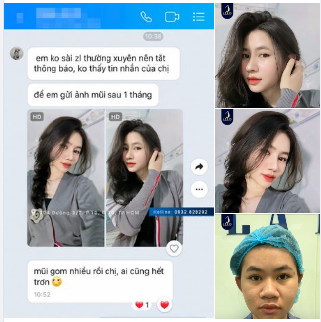 Em gái từng rất tự ti vì dáng mũi "quá khổ"