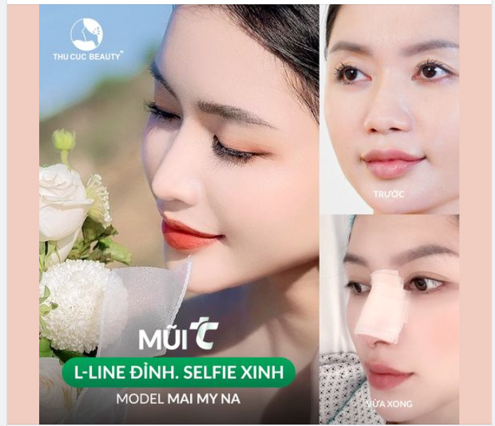 30P có ngay dáng mũi đẹp tự nhiên Chọn mũi TC