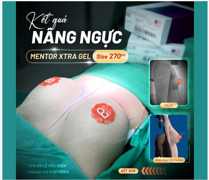 Từ mô phỏng đến thực tế. Kết quả Nâng V1 vừa thực hiện