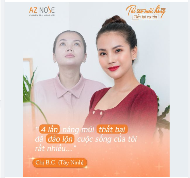 4 lần nâng mũi KHÔNG THÀNH CÔNG và những "biến cố" bất ngờ...