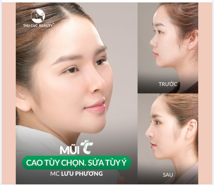 Chỉ còn 7 suất giá gốc Mũi TC hôm nay tặng ngay 28 triệu đồng