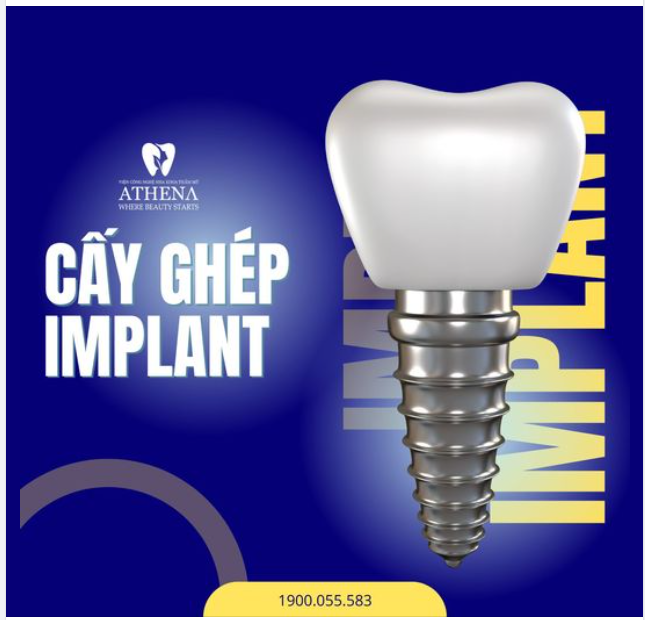 TRỒNG RĂNG IMPLANT – ĂN NHAI KHỎE, VUI VẺ TUỔI GIÀ