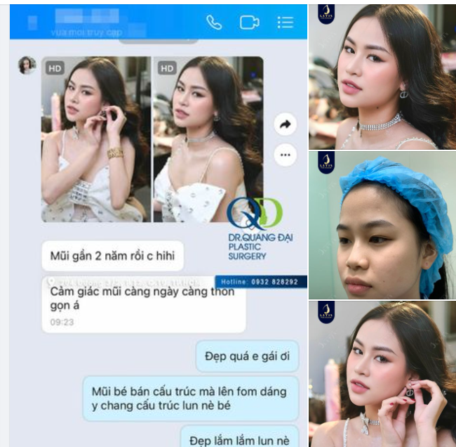 Chỉ làm mũi bán cấu trúc thôi mà...