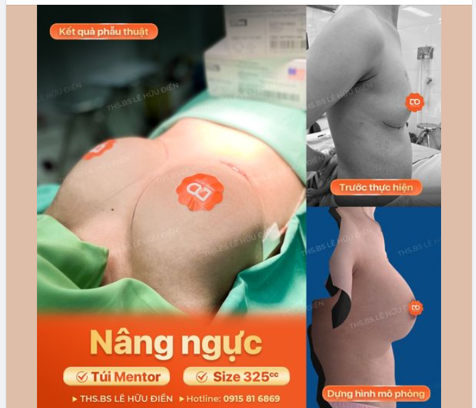 KẾT QUẢ NÂNG V1 SAU 60 PHÚT THỰC HIỆN