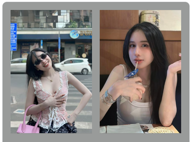 Chiếc feedback đầu tuần siêu uy tín từ bạn khách đã làm mũi cấu trúc tại Charming sau hơn 3 năm.