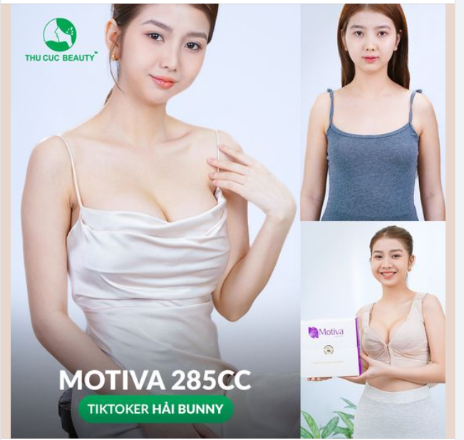 Khách hàng chọn nâng ngực túi MOTIVA 285 cc