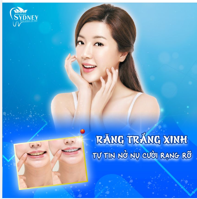 RĂNG TRẮNG XINH - TỰ TIN NỞ NỤ CƯỜI RẠNG RỠ