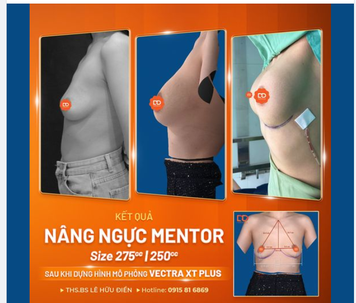 "Đập tường thành" dựng "núi đôi"  Chị khách hàng gặp tình trạng: