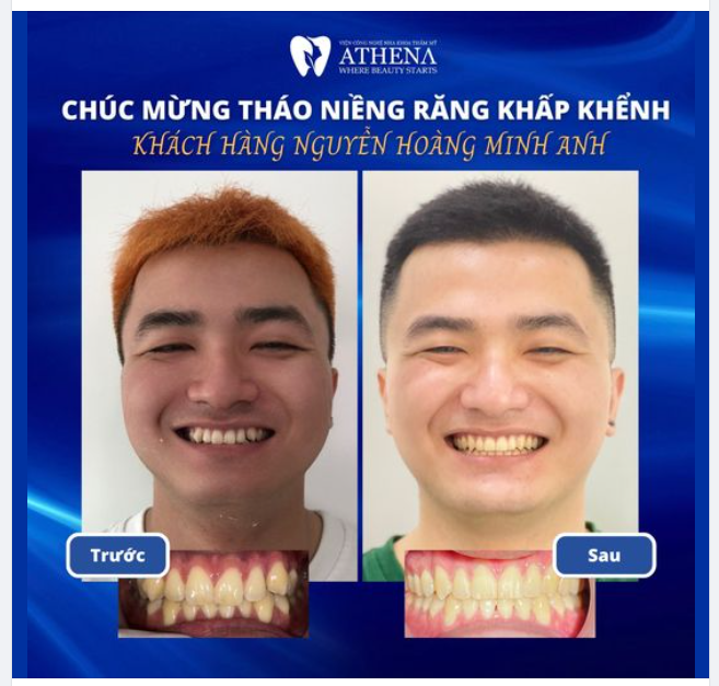 LÀ ĐÀN ÔNG CŨNG CẦN PHẢI SỞ HỮU NỤ CƯỜI ĐẸP