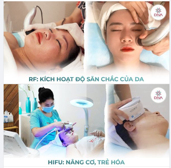 NGĂN CHẶN SỰ CHẢY XỆ KHUÔN MẶT VỚI CÔNG NGHỆ HIFU RF