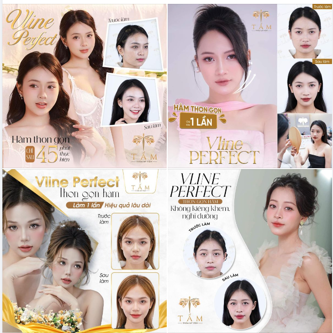 MẶT VUÔNG BẠNH, KHUÔN HÀM TO - ĐỪNG LO VÌ Ở ĐÂY ĐÃ CÓ BÍ KÍP CHO CHỊ EM