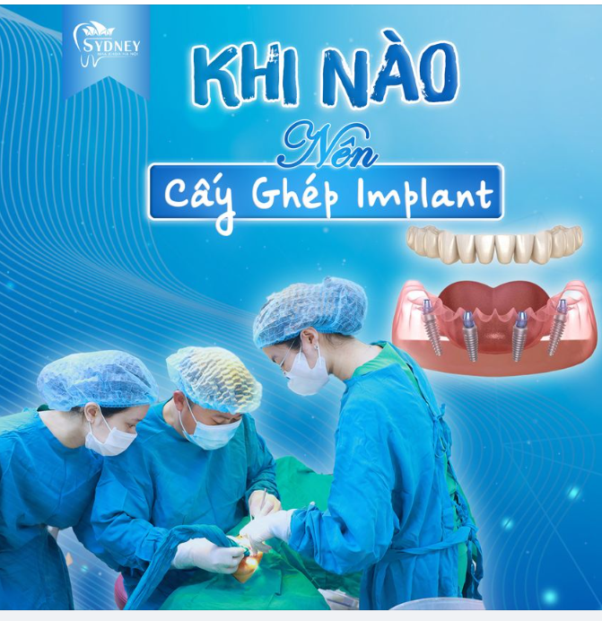 KHI NÀO NÊN CẤY GHÉP IMPLANT?