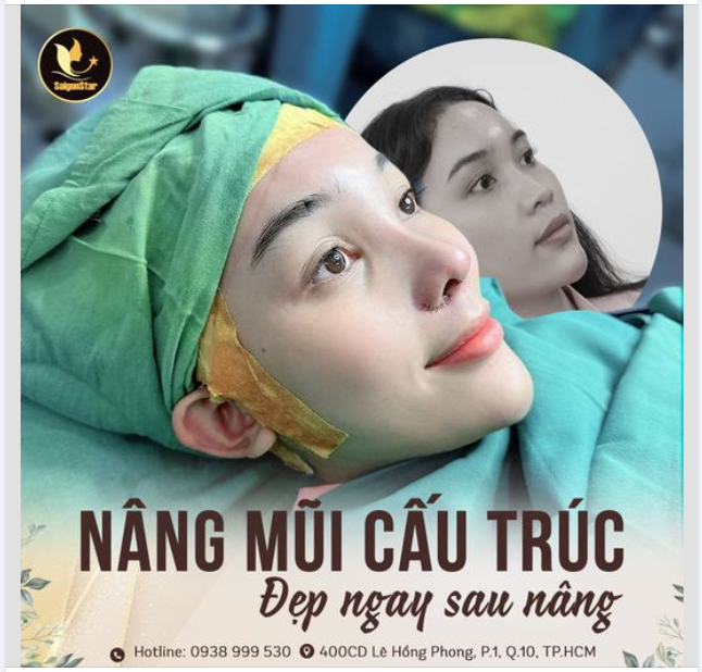 HOÀN THIỆN DÁNG MŨI CHO KHÁCH HÀNG GENZ