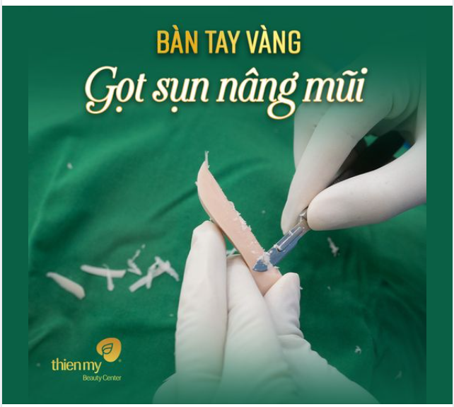 Để có dáng mũi ưng ý, chị em nên lắng nghe những chia sẻ của Bác sĩ trước khi làm, và đừng quên lựa chọn địa chỉ làm đẹp uy tín nhé! Chúc các chị em thành công.