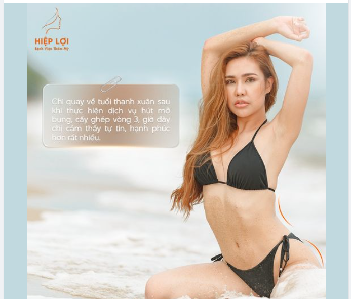 Giảm mỡ vùng bụng - Tái cấy ghép vòng 3, tự tin diện bikini