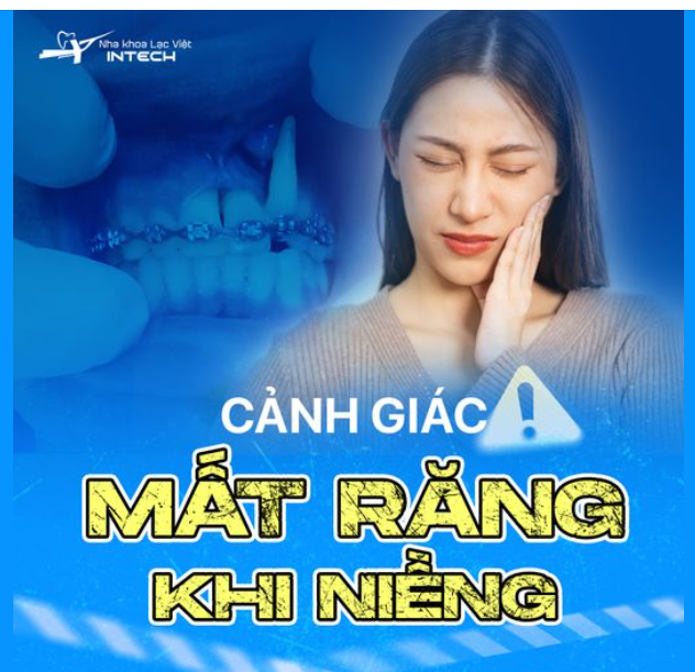 CẢNH GIÁC: NIỀNG RĂNG CÓ GÂY MẤT RĂNG KHÔNG?