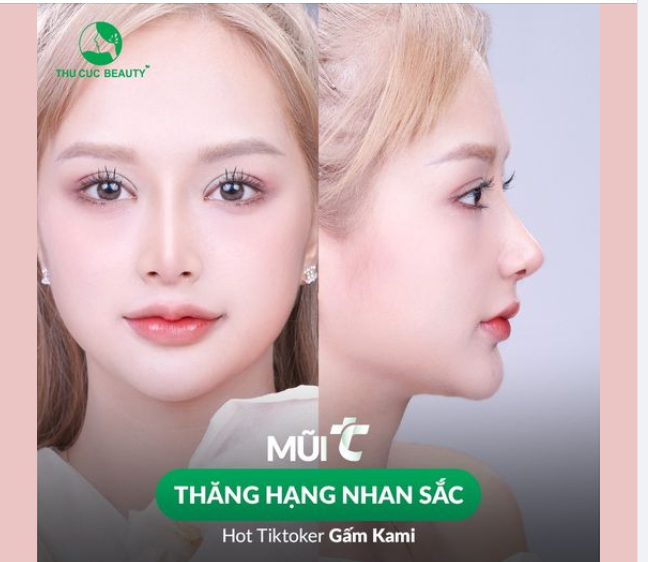 35% Mũi TC hôm nay giảm đến 30.4Tr mừng Đại lễ