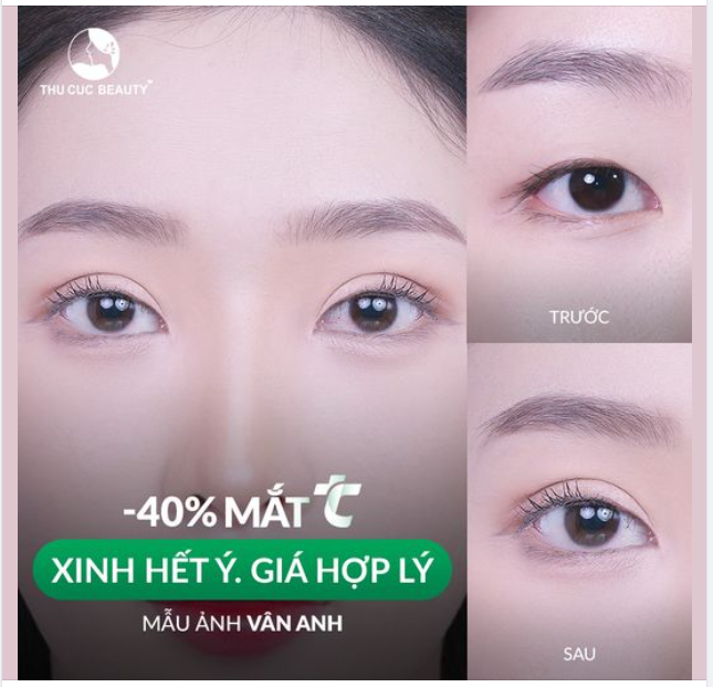 Giảm 40% Mắt hôm nay đẹp ngay đón Đại lễ