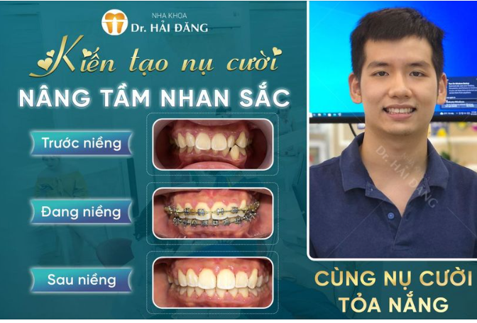KIẾN TẠO NỤ CƯỜI NÂNG TẦM NHĂN SẮC