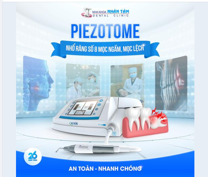 Nhổ răng số 8 an toàn bằng công nghệ Piezotome