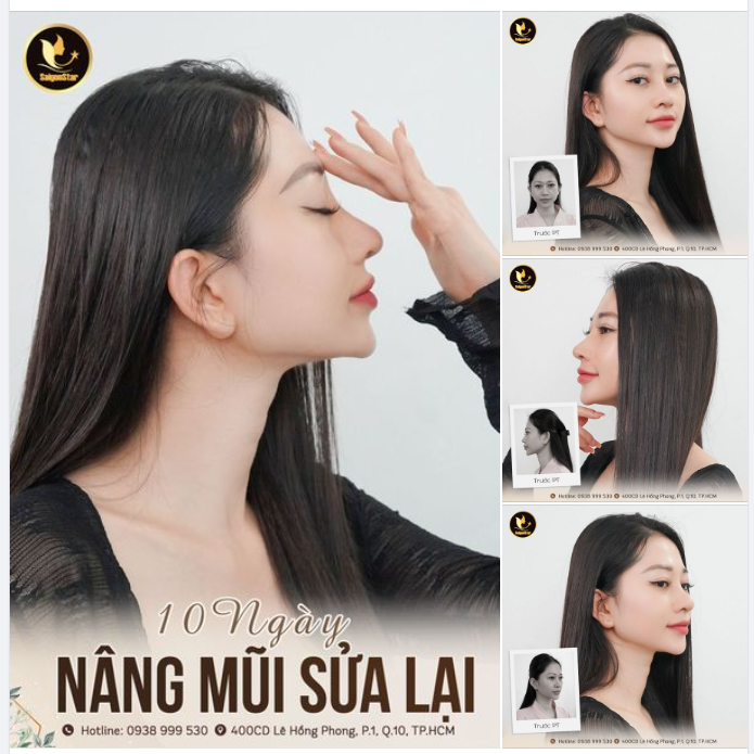 Cực phẩm ở đây, mũi đẹp ở đây