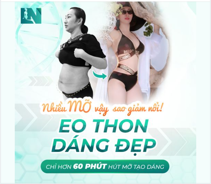 “BỤNG TO, MỠ THỪA NHIỀU VẬY LÀM SAO ĐỂ GIẢM HẾT BÁC SĨ ƠI?”
