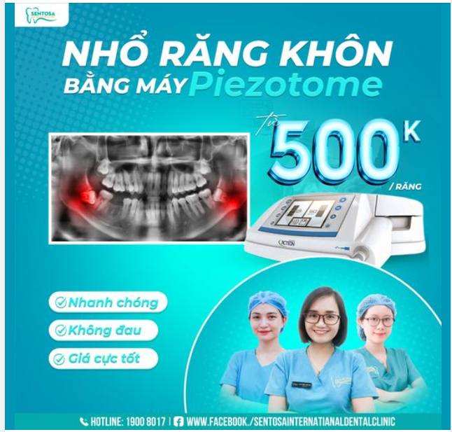 CHỈ VỚI TỪ 10 PHÚT NHỔ RĂNG HẾT ĐAU CẢ ĐỜI