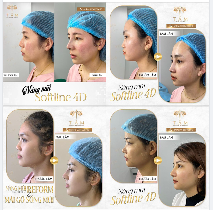 Thiết kế dáng mũi S-line mềm mại, tự nhiên hợp với tính cách nhẹ nhàng, nữ tính