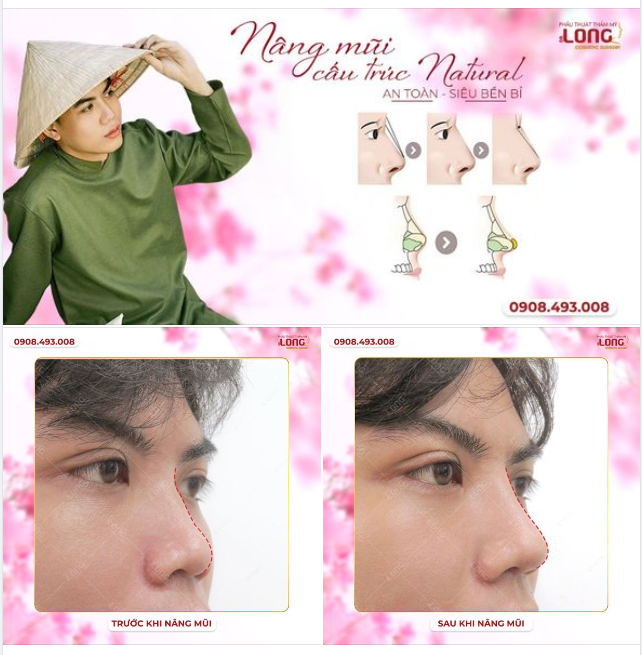 MUA “MŨI” GÌ ĐỂ ĐƯỢC “AN TOÀN - BỀN”