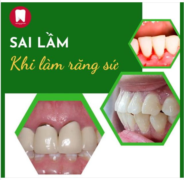 “Đừng chọn làm răng sứ rẻ rồi hối hận”