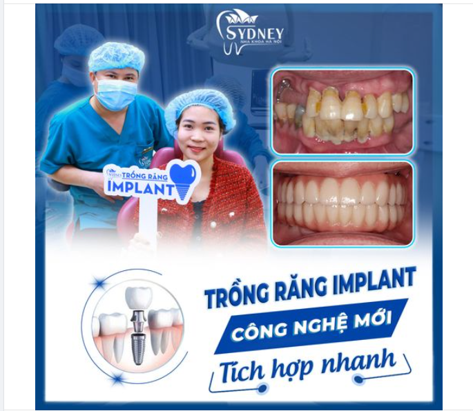 BẠN MẤT TỰ TIN VÌ HÀM RĂNG KHÔNG HOÀN HẢO?